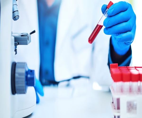 Read more about the article AI-enhanced Blood Tests could Detect Parkinson’s Disease Seven Years before Onset