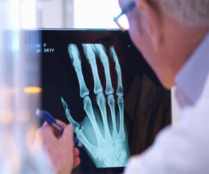 Read more about the article AI to help Doctors Spot Broken Bones on X-rays